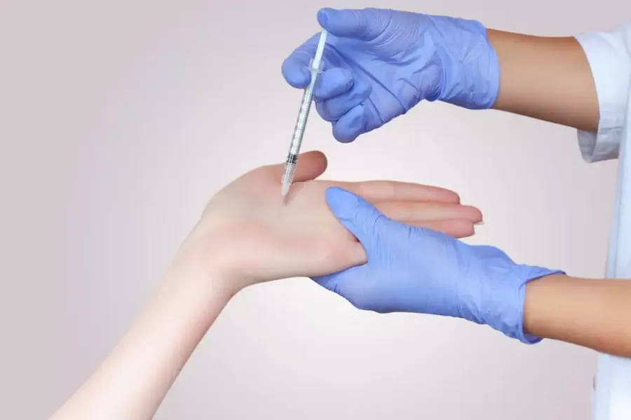 Hand Botox
