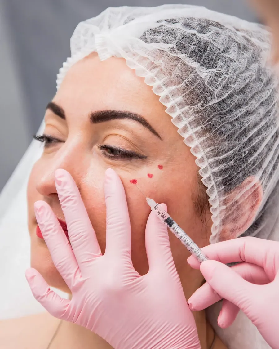 Dermal Fillers treatment at Dermalanya Oba Alanya