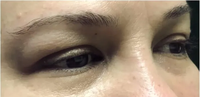 Permanent Make-up – Vorher